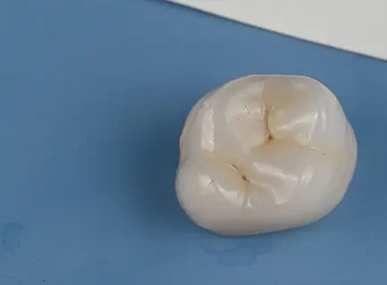 after: Ceramic crown