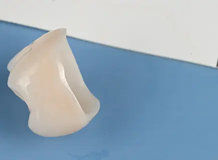 before: Ceramic crown